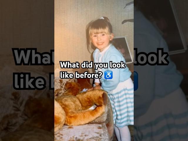 ️ What did you look like before?  Do you find it difficult to see yourself before?