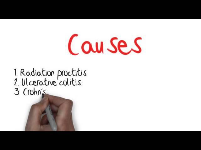 What Is Proctitis And Radiation Proctitis ?