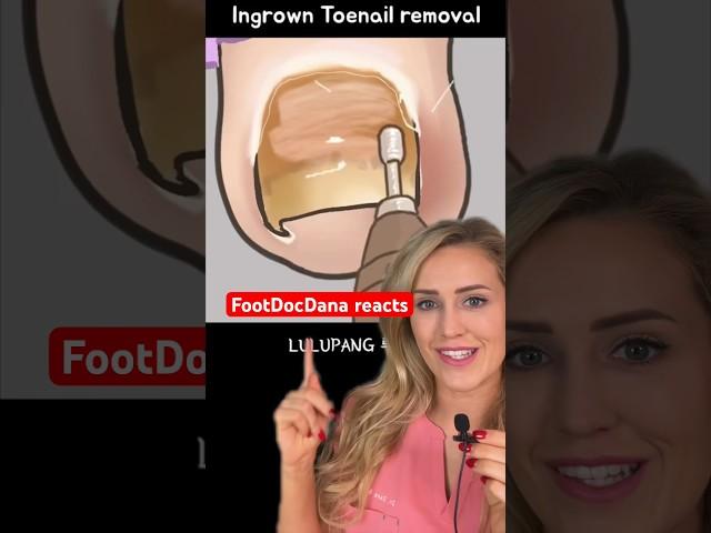 Doctor reacts: ingrown nail asmr