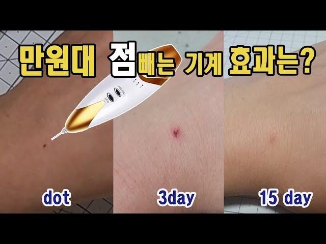 셀프 점빼기 (만원대 잡티지우개 사용후기)