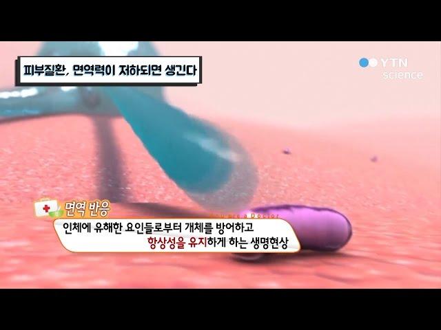 피부질환, 면역력이 저하되면 생긴다? / YTN 사이언스