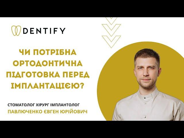 Чи потрібна ортодонтична підготовка перед імплантацією? Доктор стоматології Dentify дав відповідь