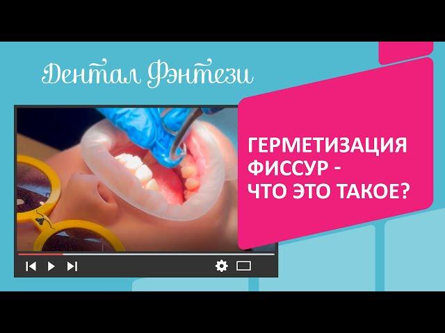   Герметизация фиссур - что это такое?