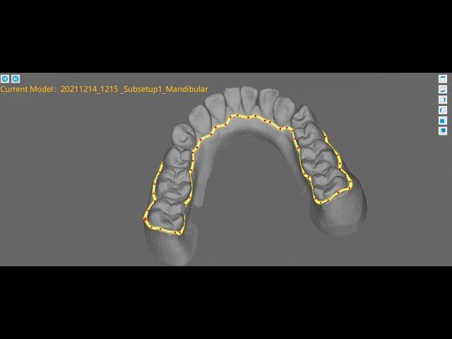 Trimming line software Orthcurve V2.1 DEMO- By Zhiyin Dental