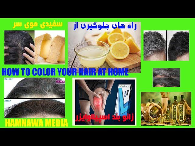 راه های جلوگیری از سفیدی مو ,علل سفیدی مو,نسخه های طبیعی برای درمان سفیدی مو