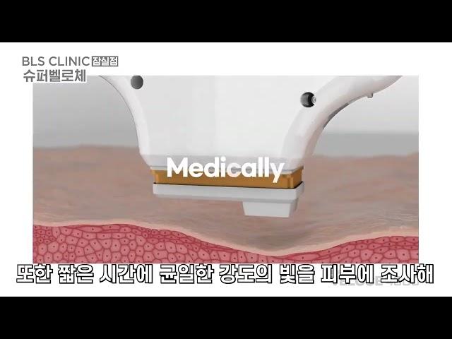 다양한 잡티를 한번에 없애고 싶다면? #슈퍼벨로체