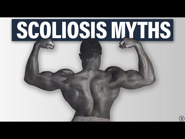 5 Facts You NEED to Know About Scoliosis (Best Exercises, Back Pain, Performance, and More!)