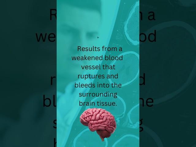Types of Stroke
