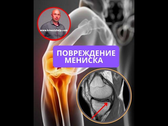 Повреждение мениска. Почему не обнаружили врачи? Что с этим делать?