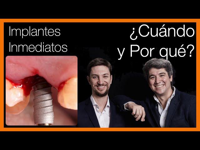 Implantes Dentales INMEDIATOS -  Cuándo y Por Qué  - Formación en Implantología Básica