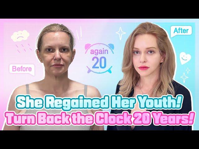 Watch How She Regains Her Youth with Amazing Results from DA Plastic Surgery Lifting!