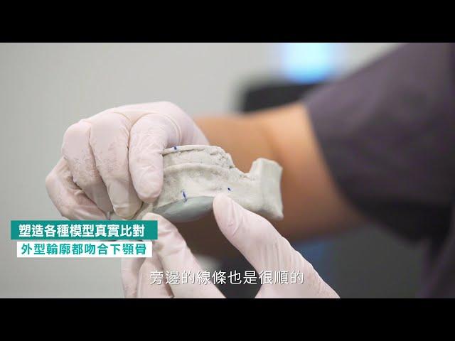 男性下巴整形手術客製化3D列印墊下巴解說 Dr.邱智弘醫師