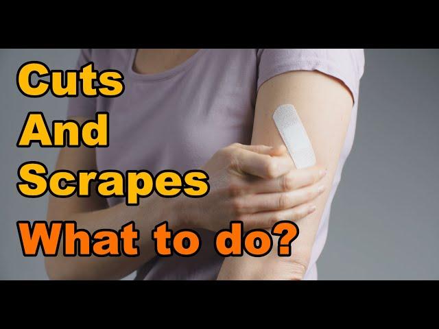 Cuts and Scrapes, What to do? First aid and how to treat cuts, scrapes and scratches. Wound Care.