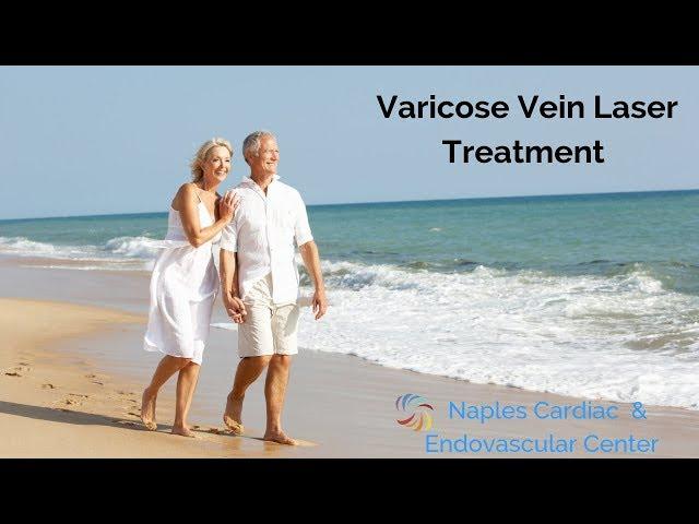 Varicose Vein Treatment with Laser by Dr  Julian Javier