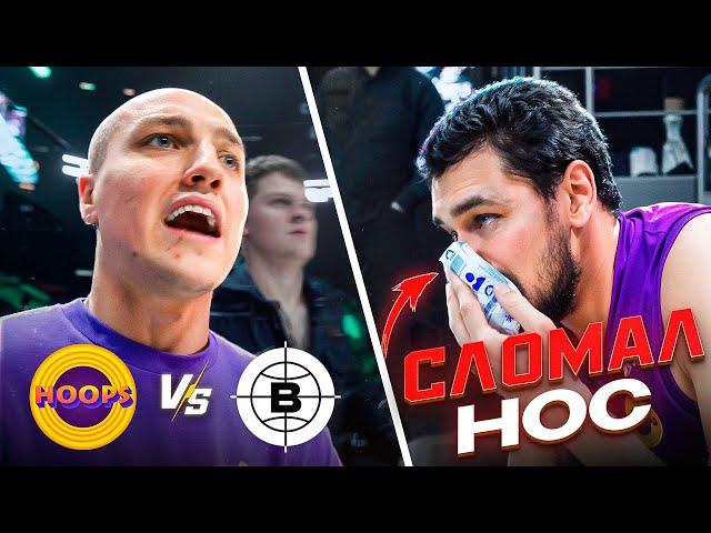 HOOPS vs BLATOSPHERA / ИГРОКУ СЛОМАЛИ НОС !