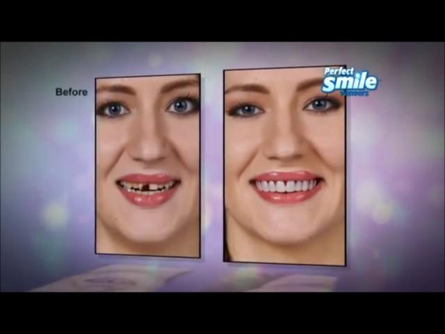 Perfect Smile Veneers - As Seen On TV