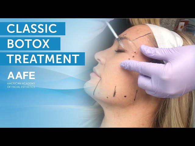 Full Face Botox Treatment | AAFE