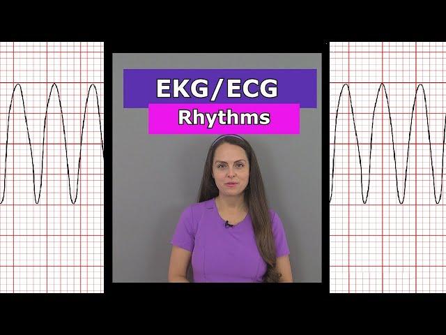 ECG EKG Heart Rhythms Nursing #shorts (afib, vtach, bradycardia, sinus rhythm, aflutter)
