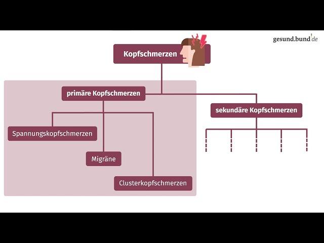 Was sind gängige Kopfschmerzarten?