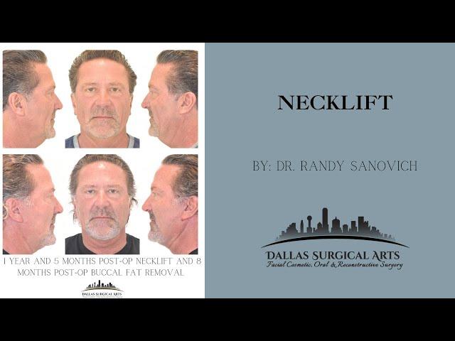 A Look Inside The OR: Necklift at Dallas Surgical Arts