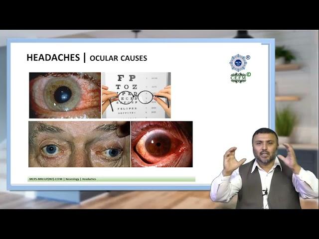 Lecture on Headache by Prof. Nasir Shah