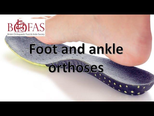 Principles of Foot and Ankle Orthoses