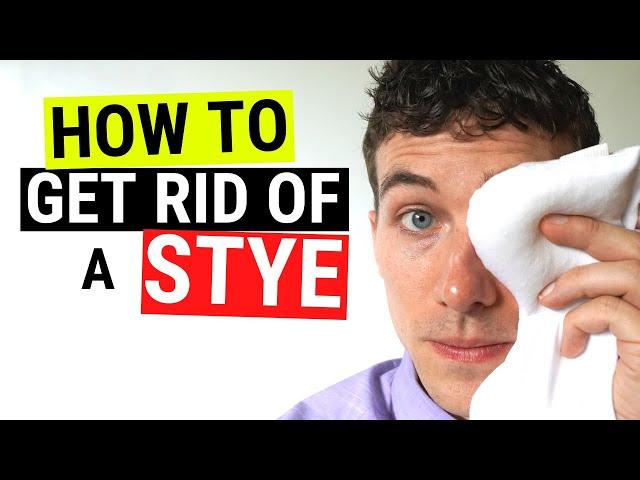 How to Get Rid of a Stye FAST - Chalazion VS Stye Treatment