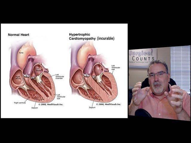 Surgical Technology Preview - Cardiac Surgery