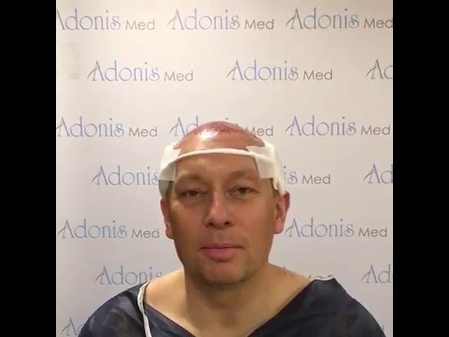 AdonisMed - Hair transplantation