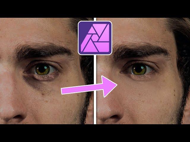 Augenringe entfernen | Affinity Photo 2 Tutorial