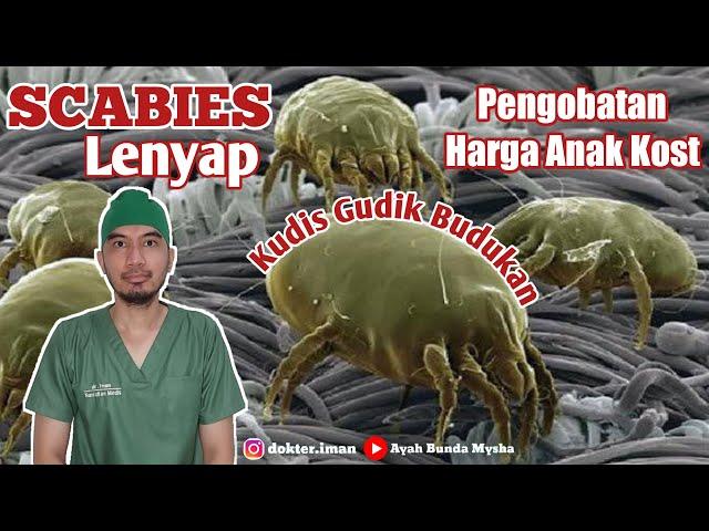 SCABIES || Gatal yang menular ‼️