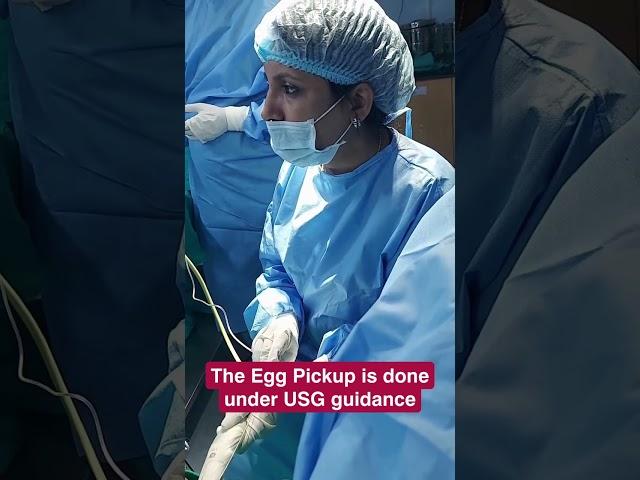 Egg pick-up or ovum pick-up is done to collect the female’s eggs for IVF treatment.