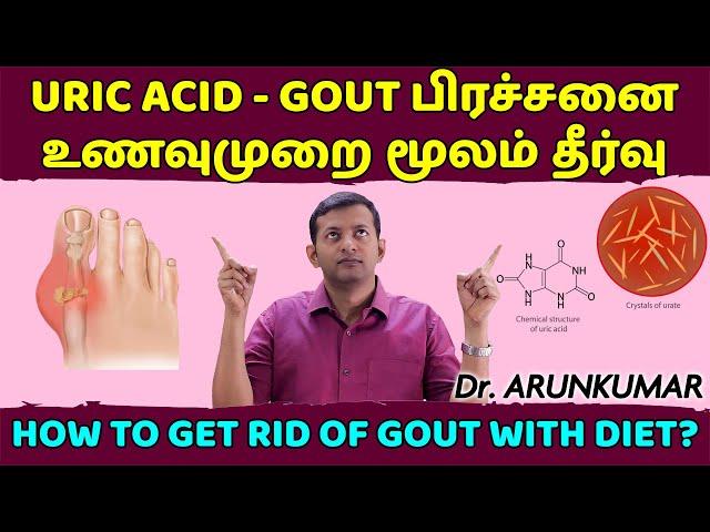 Diet plan for uric acid – gout problem | how to get rid of gout naturally? | Dr. Arunkumar