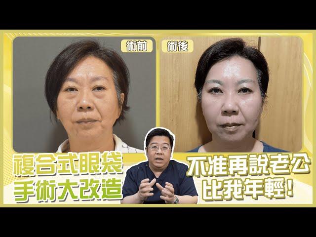複合式 眼袋手術 Chloe媽媽大改造! 不准再說老公比我年輕!｜林敬鈞醫師｜巨星整形外科