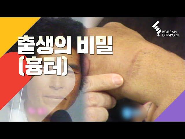 [이산가족 Eng c.c] 출생의 비밀(흉터) Birth secrets (Scars)