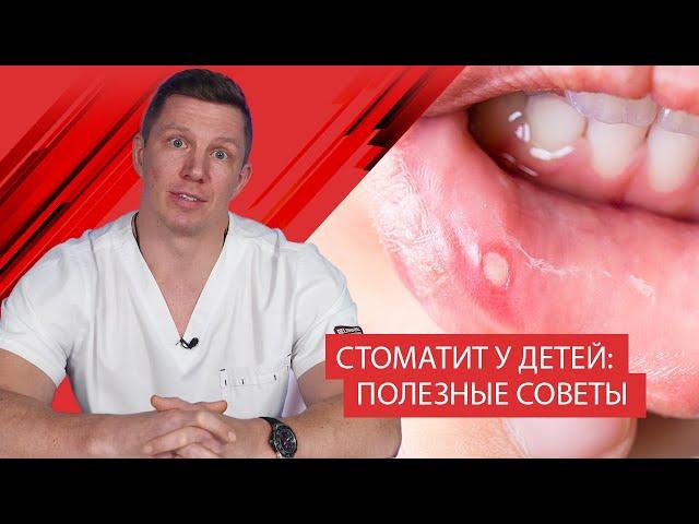 Стоматит у детей: полезные советы