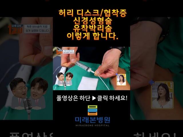 신경성형술/유착박리술 이것보고하세요!#shorts#허리디스크#협착증#신경성형술#유착박리술#나를살리는1교시#비수술적치료#미래본병원#카테타#