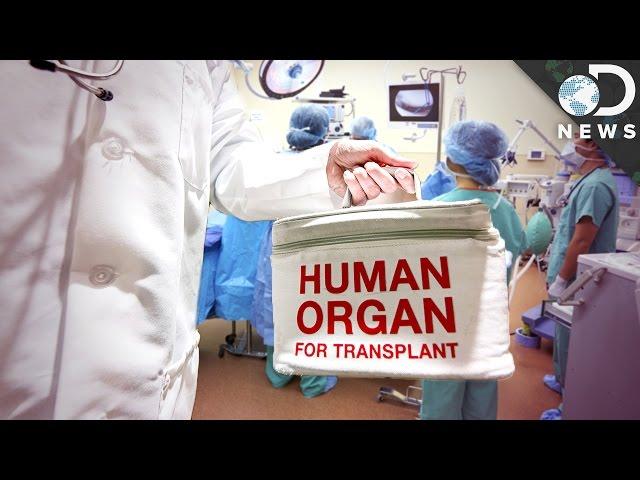 Why Do Organ Transplants Fail So Often?