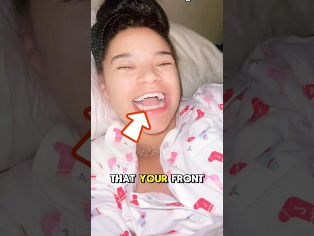 Why Your Front Teeth Don’t Touch: The Truth About Open Bite!
