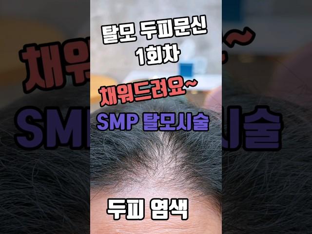 " SMP  두피문신 "여성 앞머리&가르마& 정수리 빈곳 채워드립니다! 탈모,흉터 완벽커버, 만족스러운 결과 !