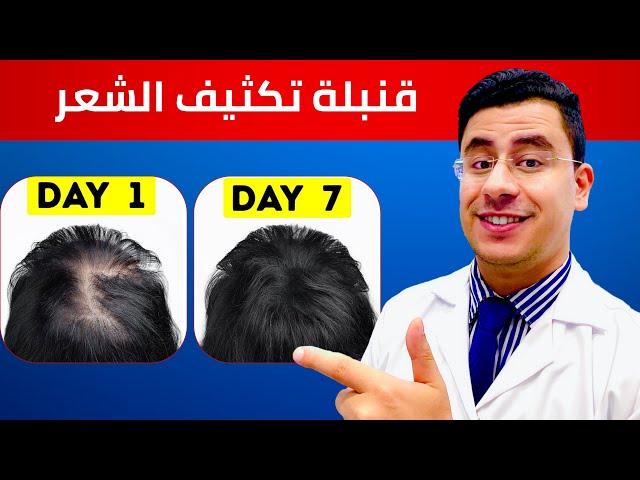 اقوي وصفة في العالم لتكثيف الشعر !