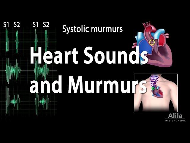 Heart Sounds and Heart Murmurs, Animation.