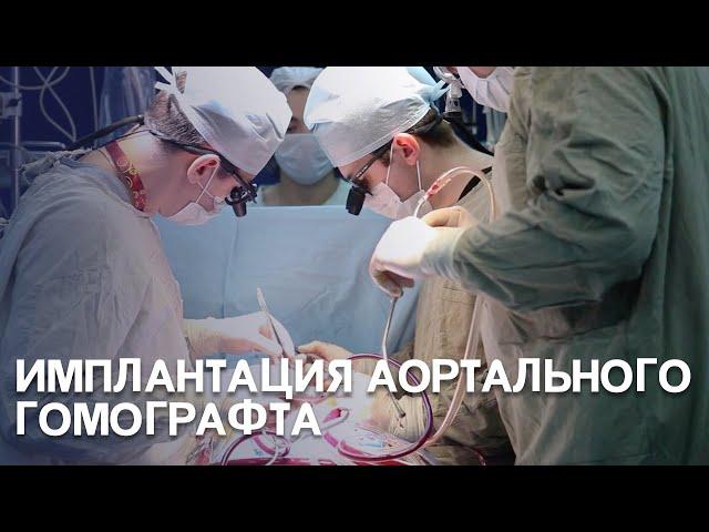 Имплантации аортального гомографта. Хирург Роман Комаров.