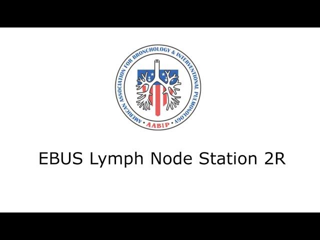 EBUS Lymph Node Station 2R