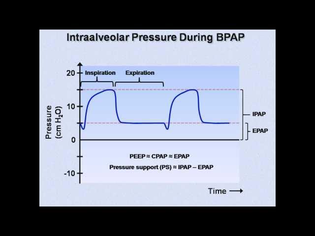 Non-Invasive Positive Pressure Ventilation (Mechanical Ventilation - Lecture 6)