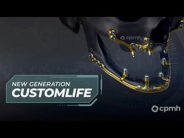 Customlife - New Geration