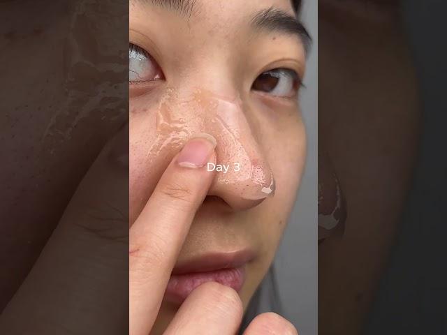 Pore Melting