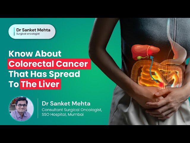 Know About Colorectal Cancer That Has Spread to the Liver | Colorectal Liver Metastasis | Dr. Sanket