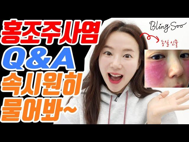 실제 경험자 조언) 안면홍조 주사염에 대해 속시원히 싹~다 알려드립니다! QnA 영상