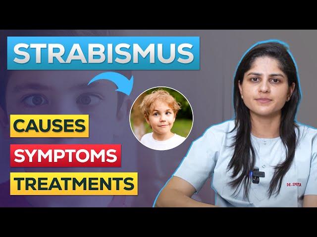 What is Strabismus or Squint Eye ? | How To Fix Strabismus Eyes